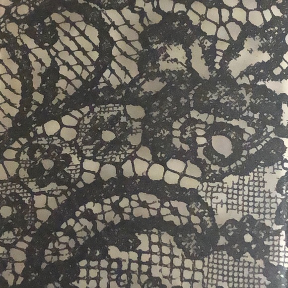 📱💕KENDALL + KYLIE 🆕 LACE IPHONE X CASE NIB💕📱 - Picture 8 of 8